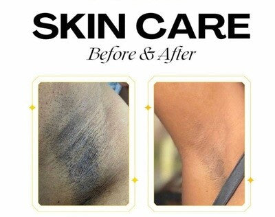 Dark Inner Thighs - 250ml