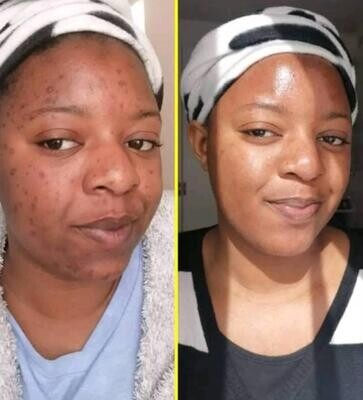 Brightening Glow Kit