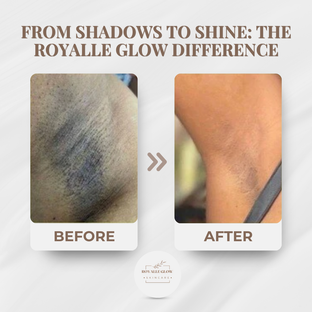 Side-by-side underarm skin photo labelled Before and After