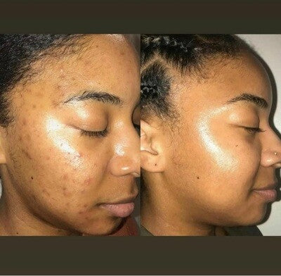 Extra Brightening Glow Kit