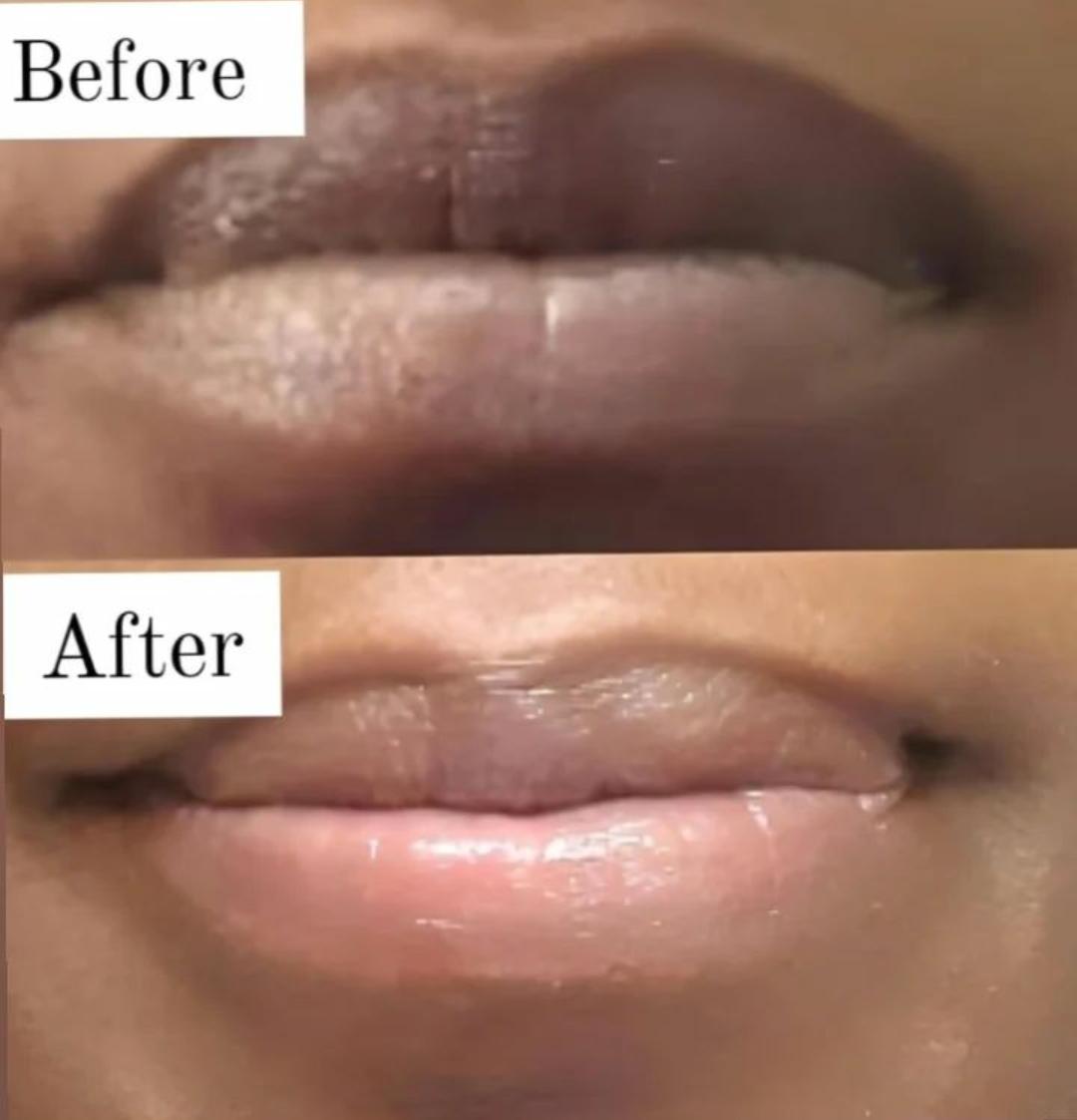 Berry Brightening Lip Combo