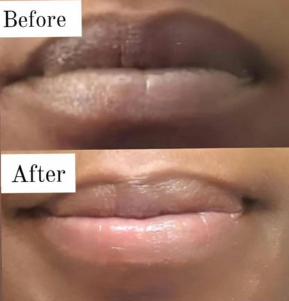 Berry Brightening Lip Combo