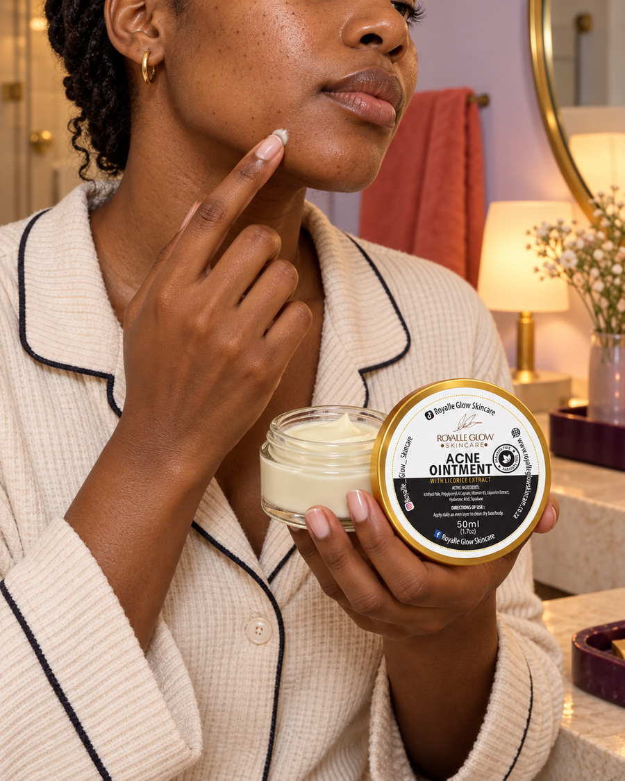 Acne Ointment 50ml in an everyday setting